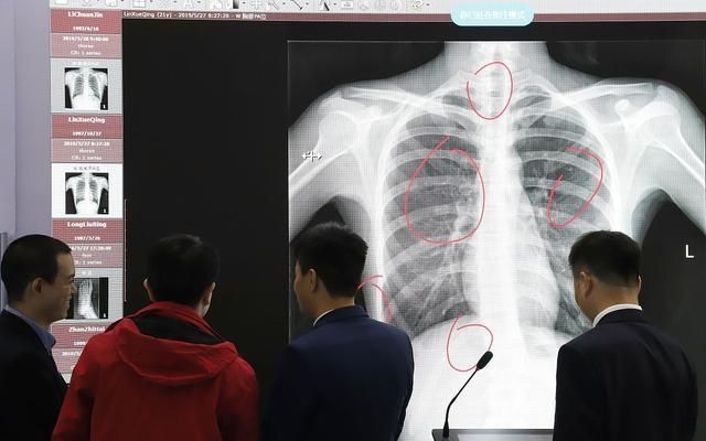 医学生如何学习数据分析