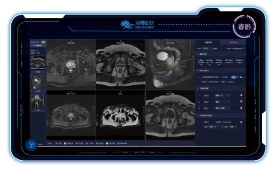 AI重构医疗生态 深睿医疗大模型新品闪耀2026医学装备展(图5)